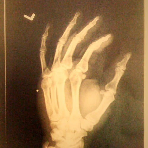 BROKE